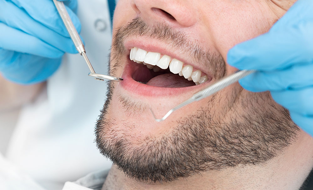 Laat uw tanden professioneel bleken door Tandartspraktijk van Laak in Uden en Erp